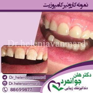 دندانپزشک کودکان (31)