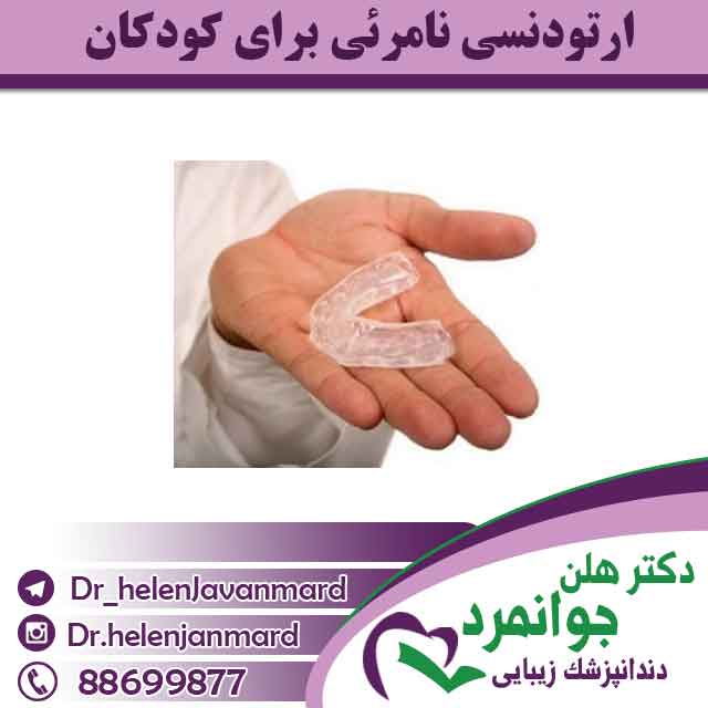 ارتودنسی نامرئی برای کودکان