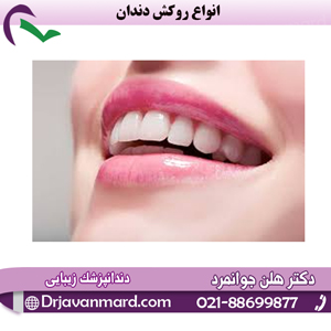 انواع روکش دندان