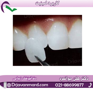 کاربرد لمینیت