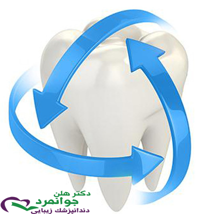 وارنیش فلوراید تراپی چیست