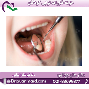 هزینه فلوراید تراپی کودکان