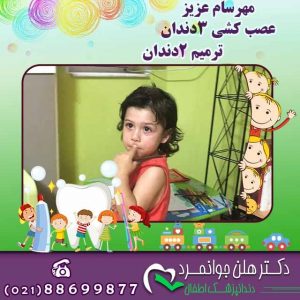 عصب کشی دندان