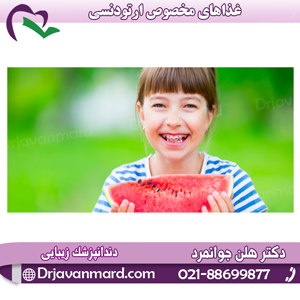 غذاهای مخصوص ارتودنسی