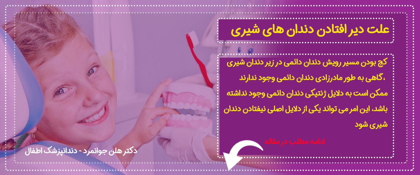 اینفوگرافیم علت دیر افتادن دندان ها