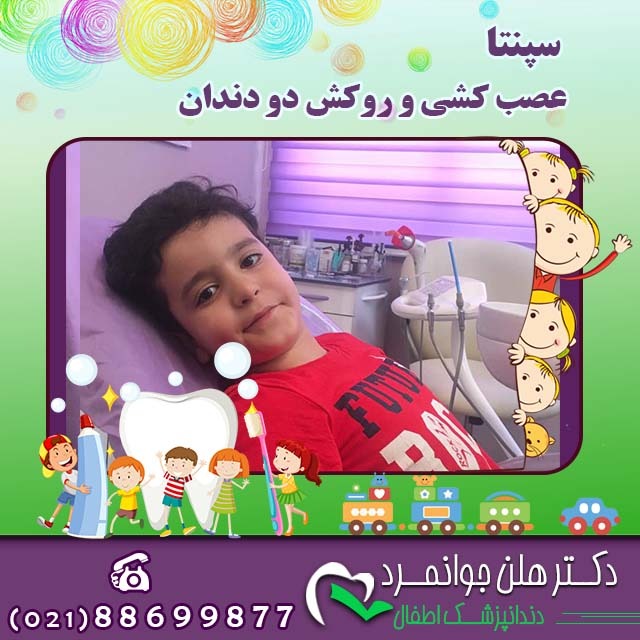 کجی دندان شیری به همراه عکس سپنتا برای عصب کشی و روکش