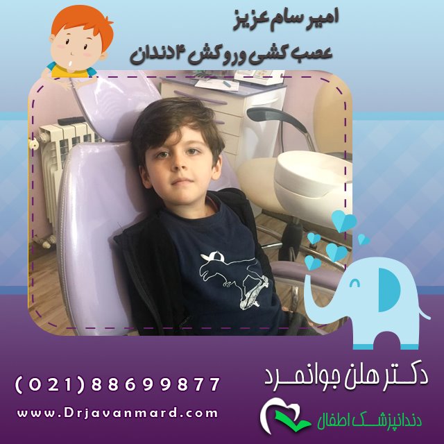 روکش دندان شیری کودکان