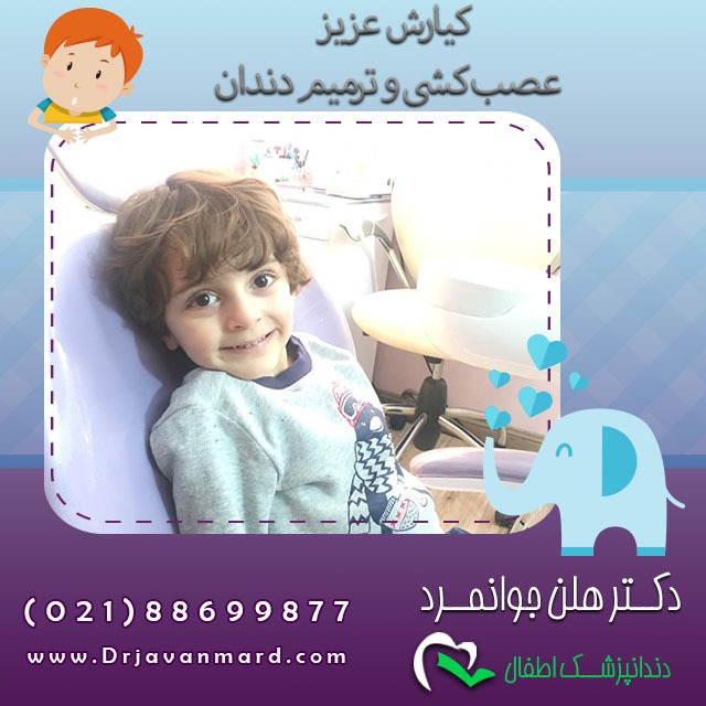 رادیوگرافی دندان کودکان - کیارش عزیز در هنگام عصب کشی و ترمیم دندان