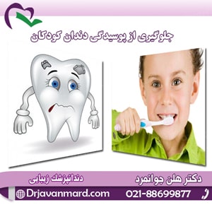 جلوگیری از پوسیدگی دندان کودکان