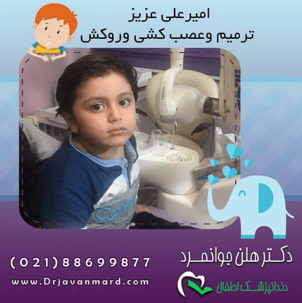 عوارض بیهوشی در دندانپزشکی کودکان - امیر علی عزیز با ترمیم و عصب کشی