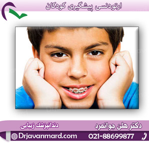 ارتودنسی پیشگیری کودکان