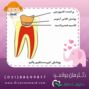 پوشش پالپ در دندان های شیری و دائمی