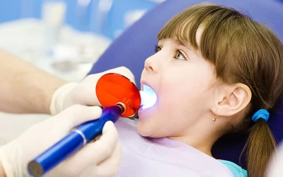 فیشور سیلانت دندان شیری