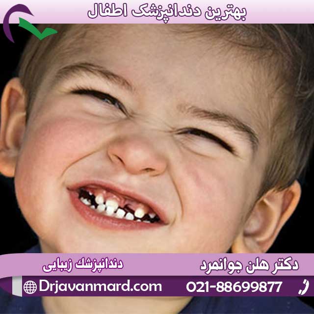 علت دندان قروچه کودکان