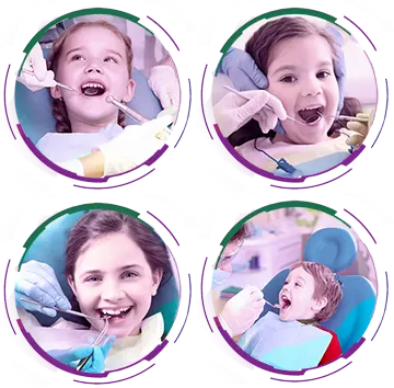 روکش دندان شیری چیست