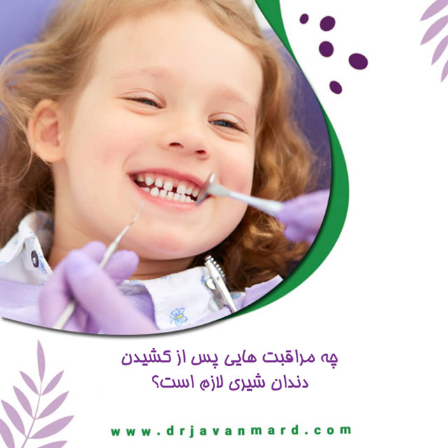بعد از کشیدن دندان های شیری کودک، چه مراقبت هایی لازم است؟