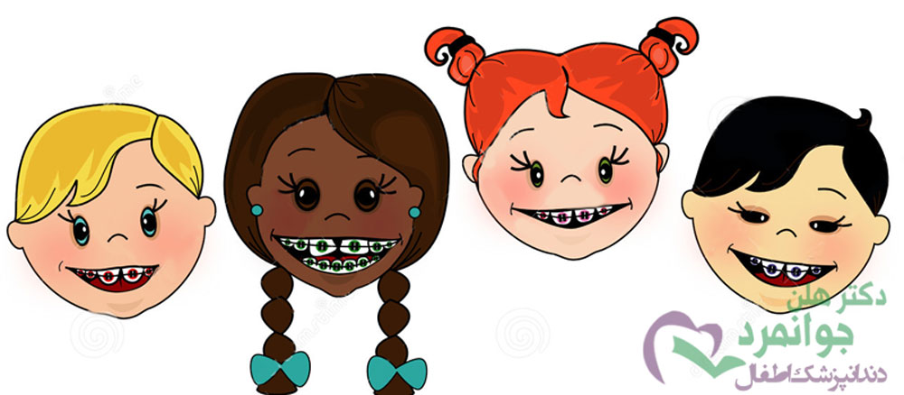 ارتودنسی اطفال