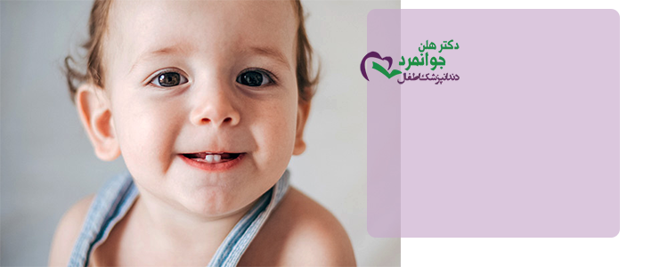 خرابی در دندان کودکان