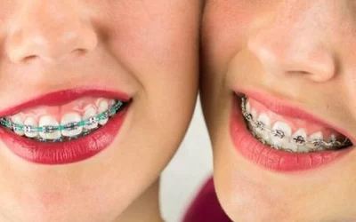 ارتودنسی در کودکان