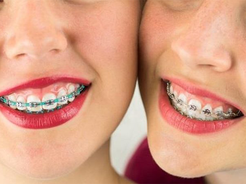 ارتودنسی در کودکان