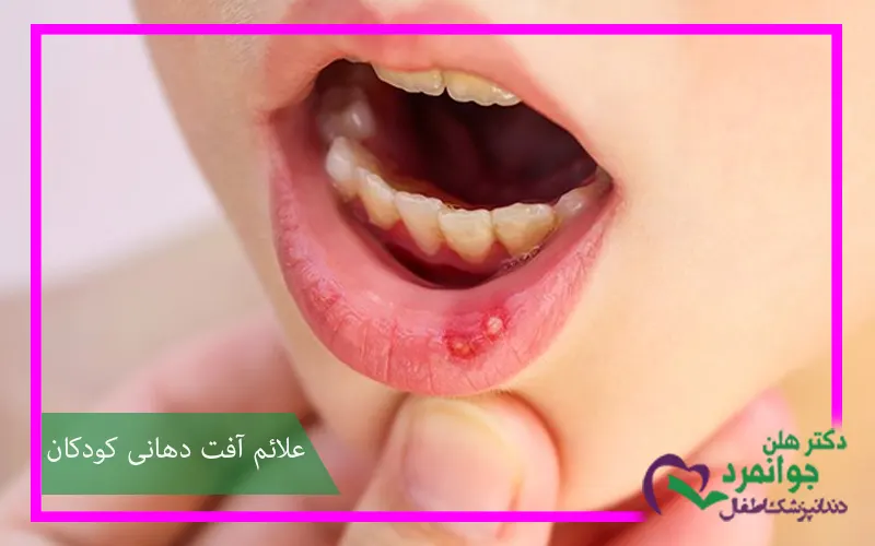 علائم-آفت-دهانی-کودکان