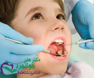 سن کودک
میزان آسیب یا عفونت دندان
سلامت و حال عمومی کودک
موقعیت مکانی دندان آسیب دیده