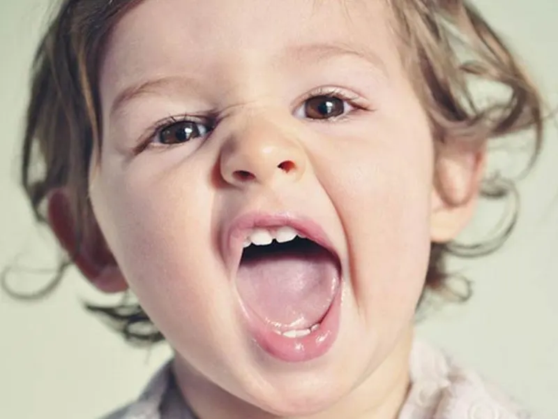 علت تورم و التهاب لثه در کودکان